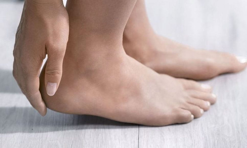 Aquaphor for cheap cracked feet